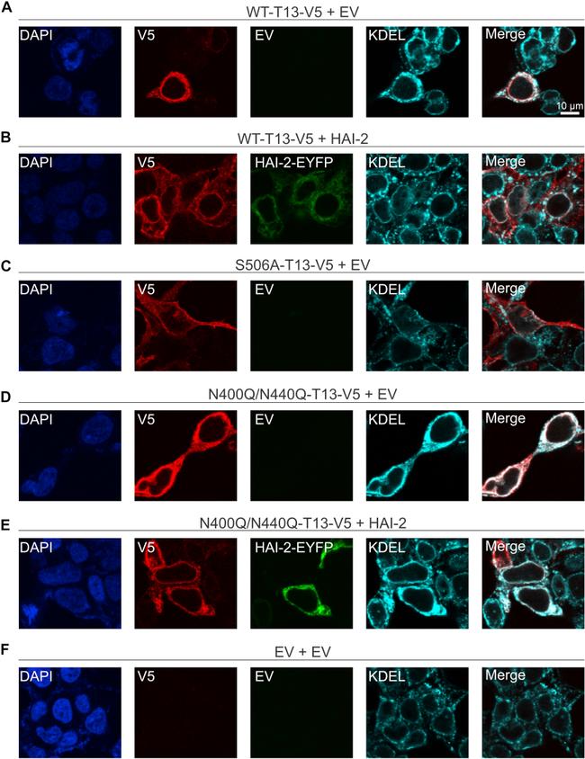 KDEL Antibody in Immunocytochemistry (ICC/IF)