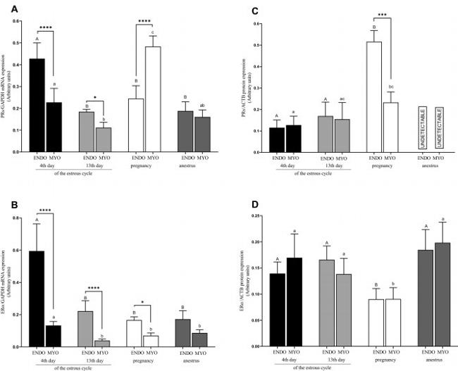 Progesterone Receptor Antibody in Western Blot (WB)