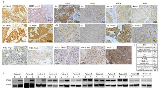 SRC (active) Antibody in Immunohistochemistry (IHC)