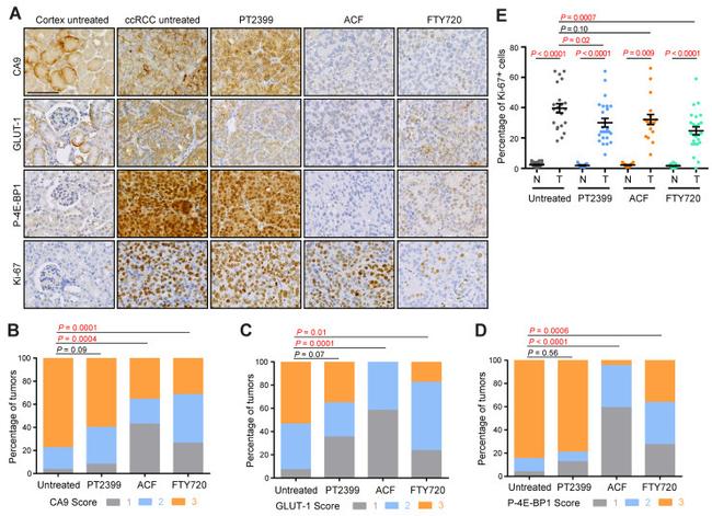 Carbonic Anhydrase IX Antibody in Immunohistochemistry (IHC)