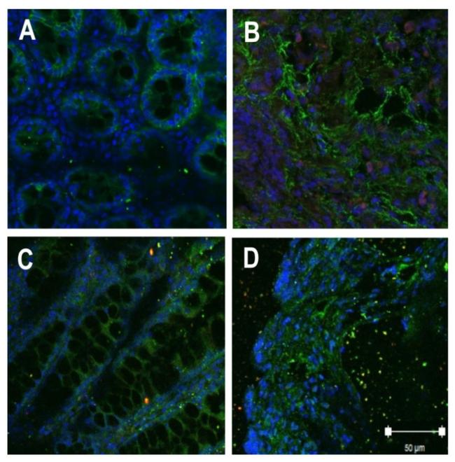 Claudin 3 Antibody in Immunohistochemistry (Paraffin) (IHC (P))