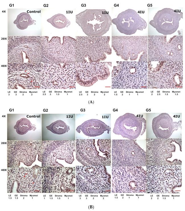 Progesterone Receptor Antibody in Immunohistochemistry (IHC)