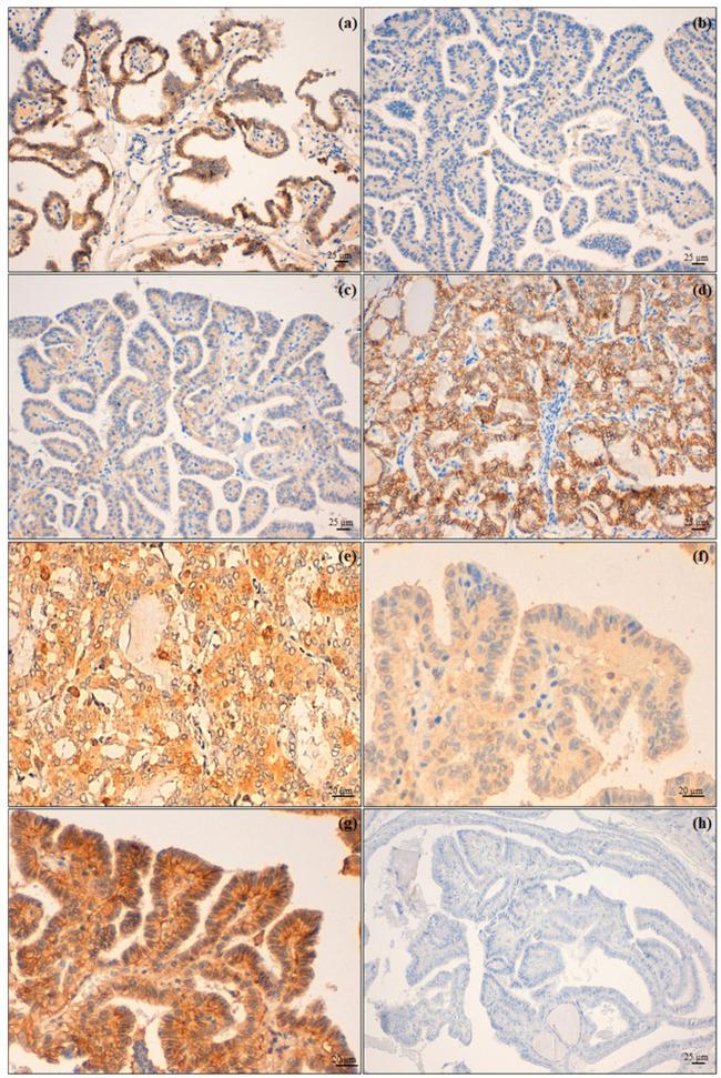 CD147 (soluble) Antibody in Immunohistochemistry (IHC)