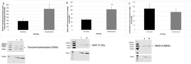 SLC6A4 Antibody in Western Blot (WB)