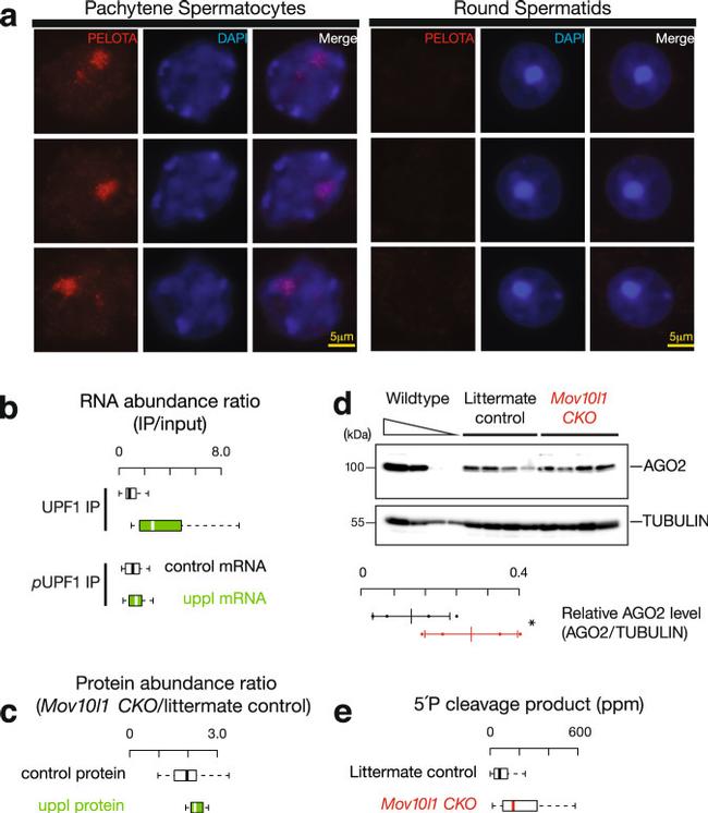 PELO Antibody in Immunocytochemistry (ICC/IF)