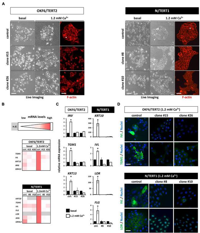 LOR Antibody in Immunocytochemistry (ICC/IF)