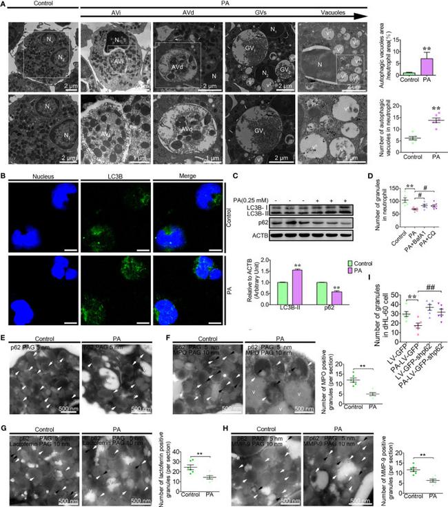 MMP9 Antibody in Immunohistochemistry (IHC)