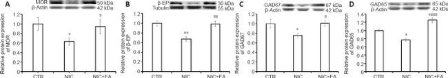 OPRM1 Antibody in Western Blot (WB)