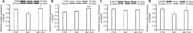 OPRM1 Antibody in Western Blot (WB)