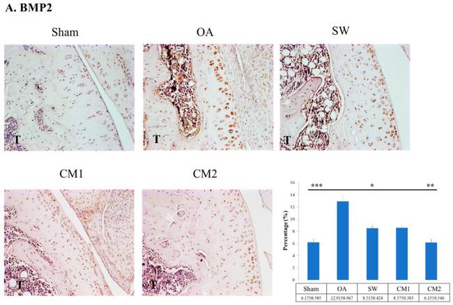 BMP5 Antibody in Immunohistochemistry (IHC)