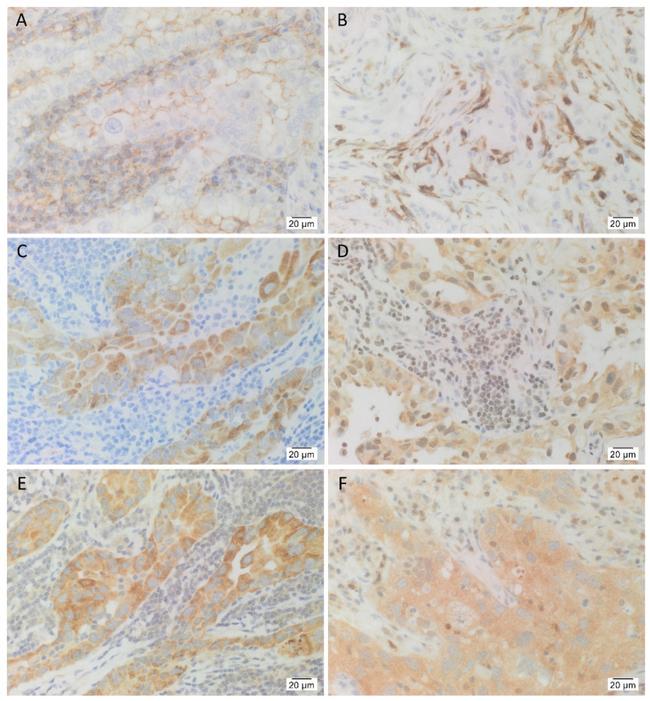 SOX2 Antibody in Immunohistochemistry (IHC)