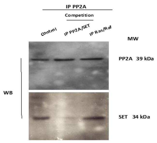 SET Antibody in Western Blot (WB)