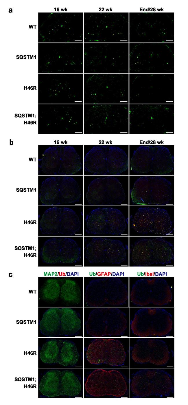 SQSTM1 Antibody in Immunocytochemistry (ICC/IF)