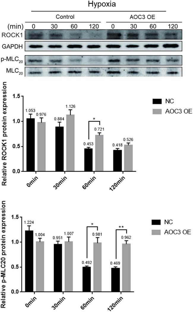 ROCK1 Antibody in Western Blot (WB)