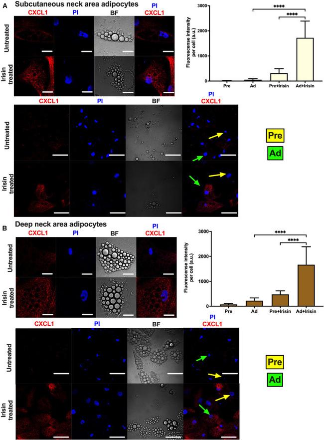 CXCL1 Antibody in Immunocytochemistry (ICC/IF)