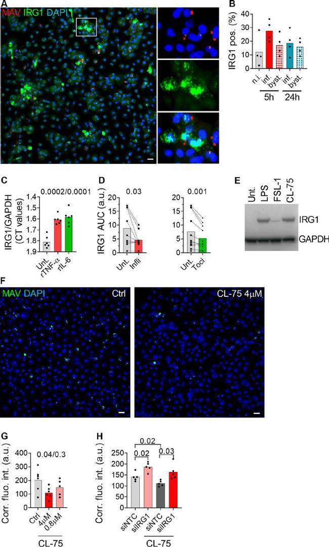 IRG1 Antibody in Western Blot, Immunocytochemistry (WB, ICC/IF)