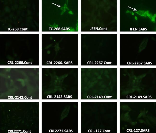 SARS/SARS-CoV-2 Nucleocapsid Antibody in Immunocytochemistry (ICC/IF)