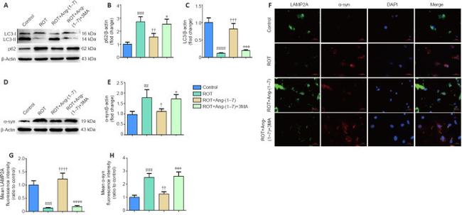 alpha Synuclein Antibody in Immunocytochemistry (ICC/IF)