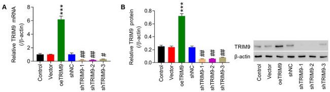 TRIM9 Antibody in Western Blot (WB)