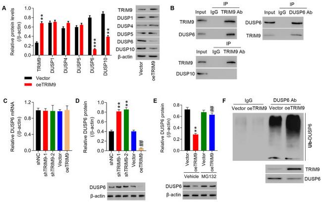 TRIM9 Antibody in Western Blot, Immunoprecipitation (WB, IP)