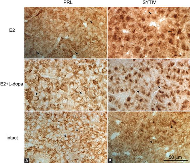 Prolactin Antibody in Immunohistochemistry (IHC)