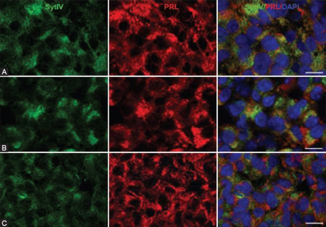 Prolactin Antibody in Immunohistochemistry (IHC)