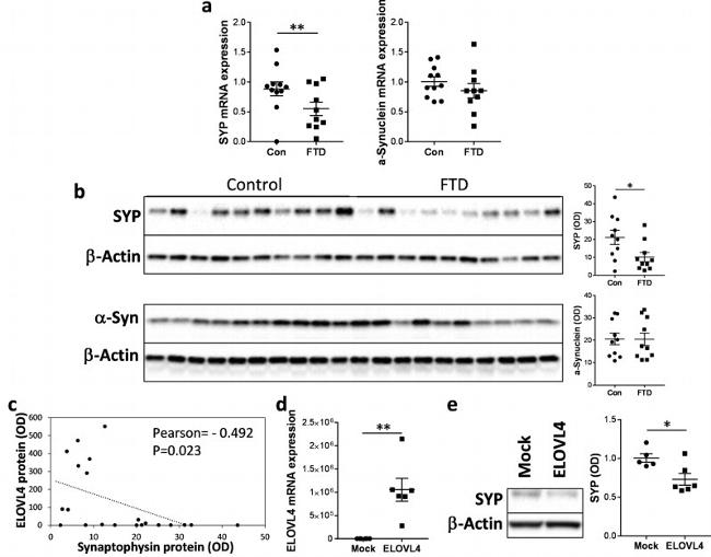 Synaptophysin Antibody in Western Blot (WB)