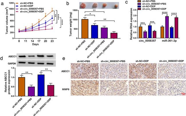 MMP9 Antibody in Immunohistochemistry (IHC)