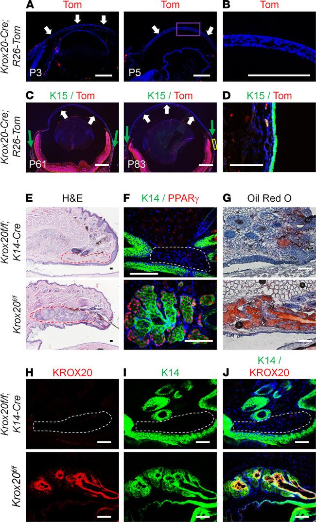 EGR2 Antibody in Immunohistochemistry (IHC)