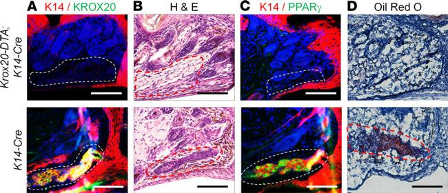 EGR2 Antibody in Immunohistochemistry (IHC)