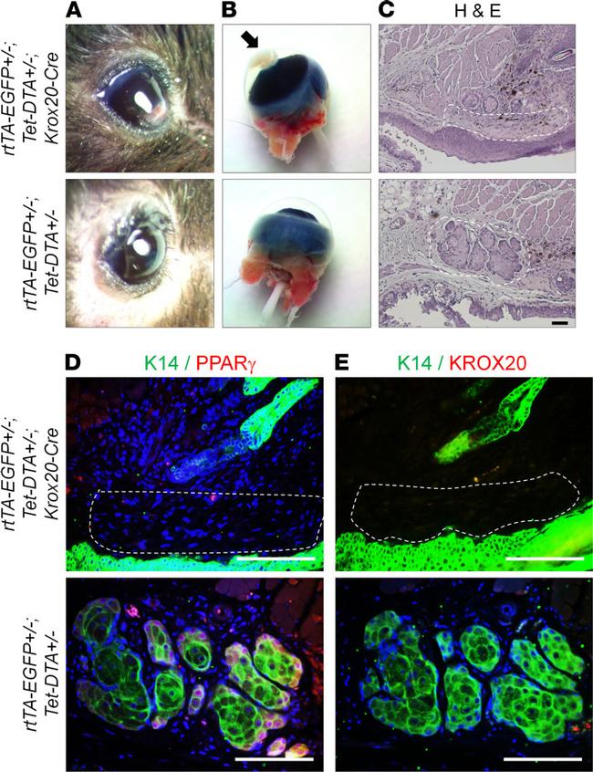 EGR2 Antibody in Immunohistochemistry (IHC)