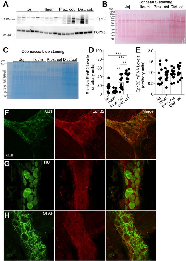 HuD Antibody in Immunohistochemistry (IHC)