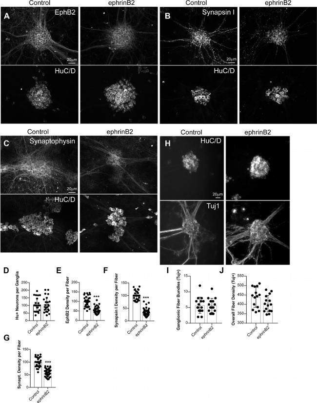 HuD Antibody in Immunohistochemistry (IHC)