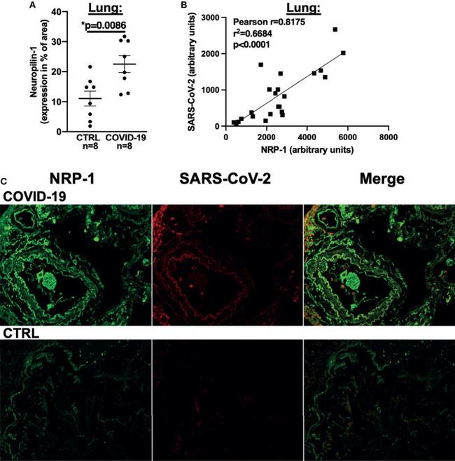 SARS/SARS-CoV-2 Nucleocapsid Antibody in Immunohistochemistry, Immunohistochemistry (Paraffin) (IHC, IHC (P))