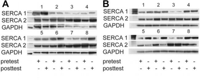 SERCA2 ATPase Antibody in Western Blot (WB)