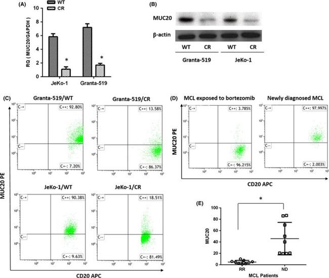 MUC20 Antibody in Western Blot (WB)