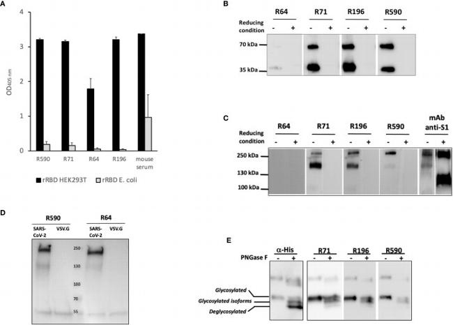 SARS-CoV-2 Spike Protein S1 Antibody in Western Blot (WB)