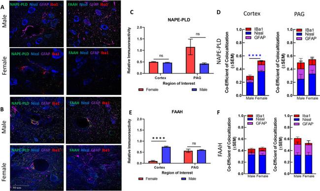 GFAP Antibody in Immunohistochemistry (IHC)