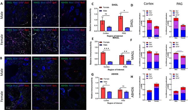 GFAP Antibody in Immunohistochemistry (IHC)