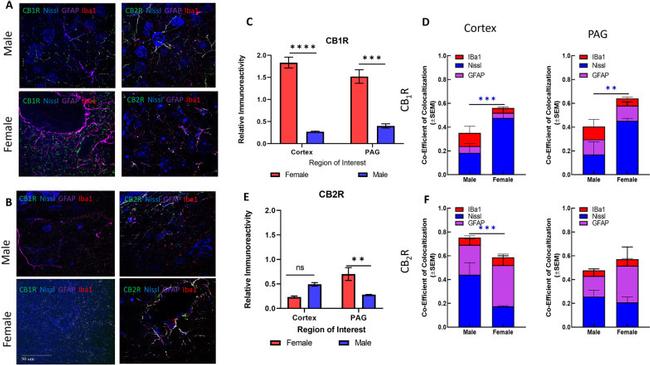 IBA1 Antibody in Immunohistochemistry (IHC)