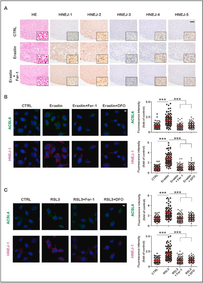 ACSL4 Antibody in Immunocytochemistry (ICC/IF)