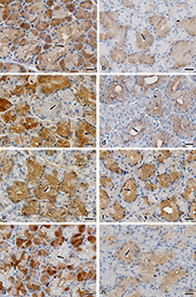 Lysozyme Antibody in Immunohistochemistry (IHC)