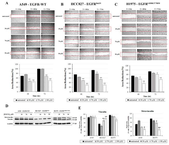 Vinculin Antibody in Western Blot (WB)