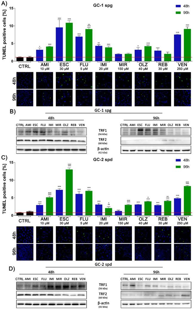 TRF2 Antibody in Western Blot (WB)