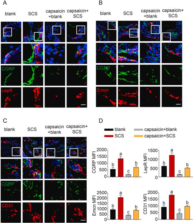 Leptin Receptor Antibody in Immunohistochemistry, Immunohistochemistry (Frozen) (IHC, IHC (F))