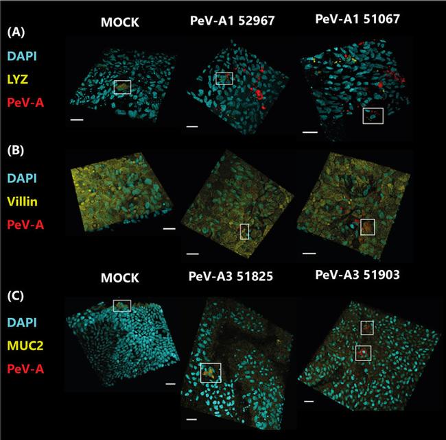 MUC2 Antibody in Immunocytochemistry (ICC/IF)