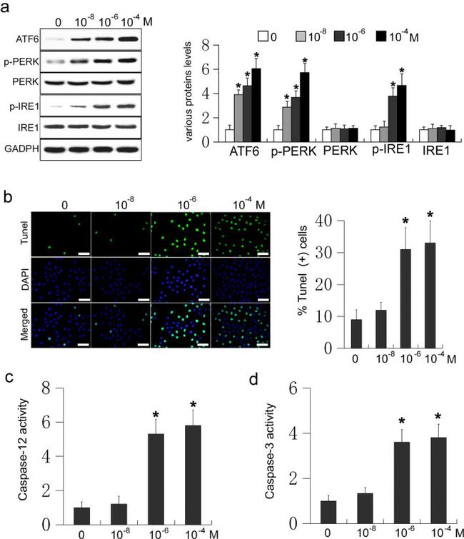 IRE1 alpha Antibody in Western Blot (WB)