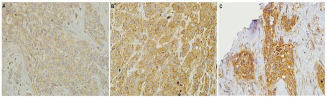 HMGCR Antibody in Immunohistochemistry (IHC)