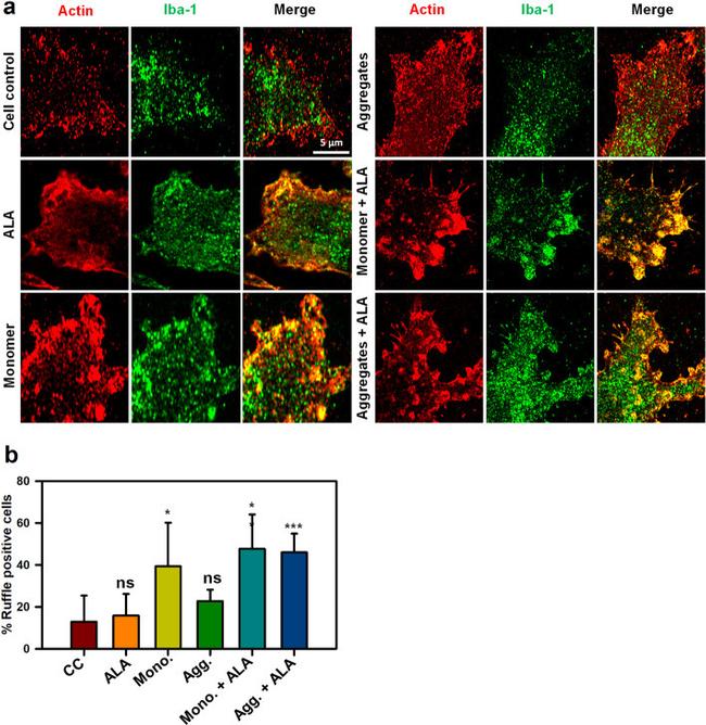 IBA1 Antibody in Immunocytochemistry (ICC/IF)