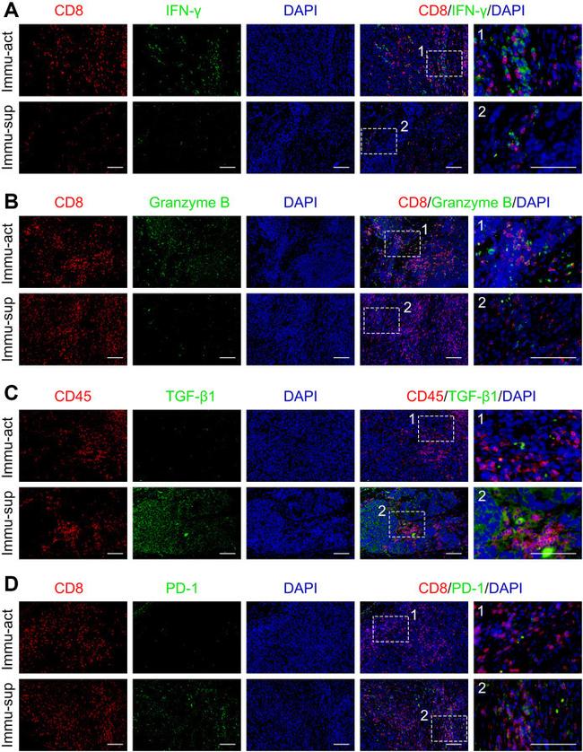 TGF beta-1 Antibody in Immunohistochemistry (IHC)